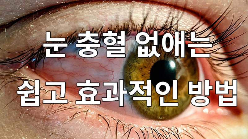 눈 충혈 없애는 쉽고 효과적인 방법