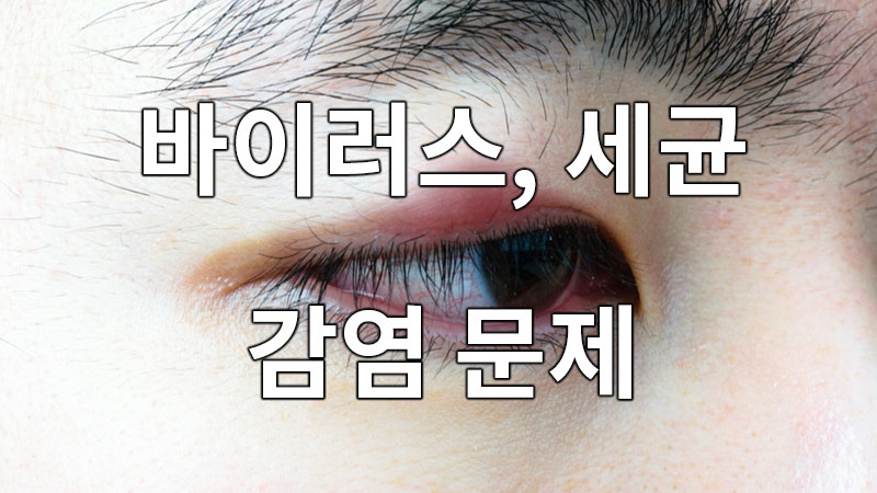 바이러스, 세균 감염에 의한 문제