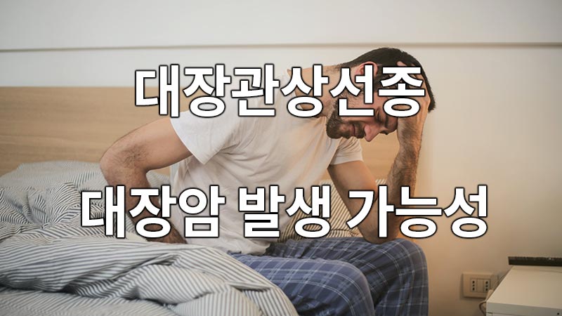 대장관상선종 발생원인, 대장암 발생 가능성은?