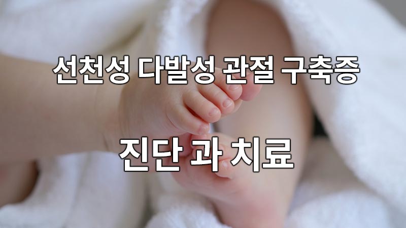 선천성 다발성 관절 구축증 진단과 치료
