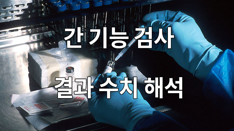 간 기능 검사 결과 수치 해석