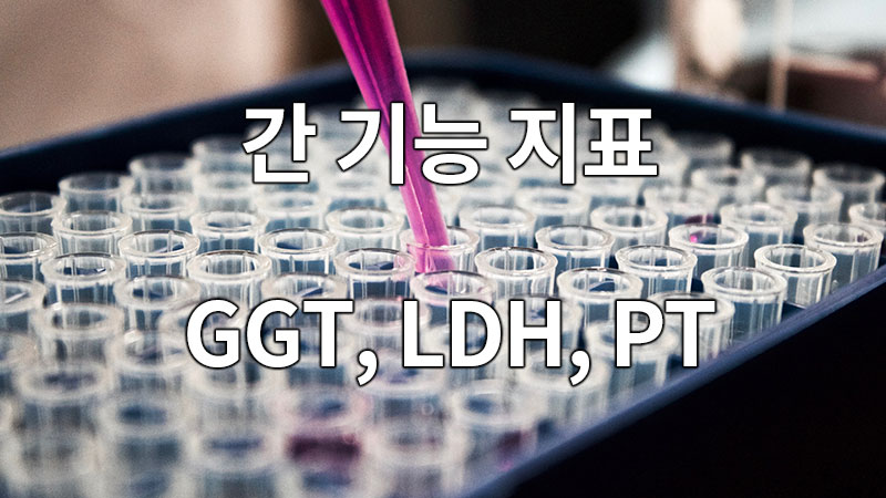 간 기능 지표 GGT, LDH, PT