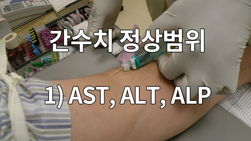 간수치 정상범위 1) AST, ALT, ALP 팩트 확인!