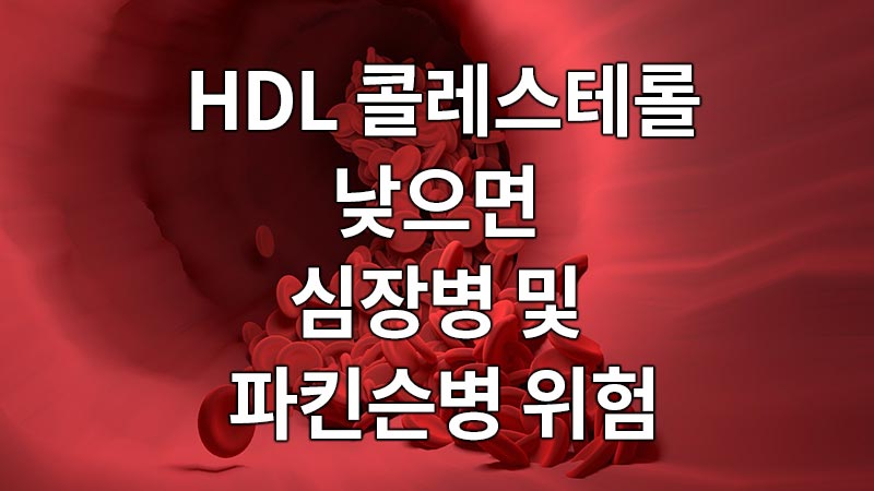 HDL 콜레스테롤 낮으면, 심장병 및 파킨슨병 위험!