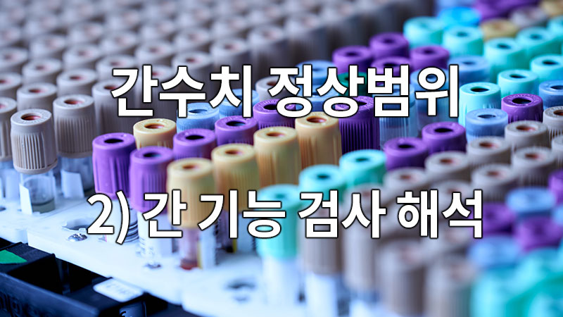 간수치 정상범위 2) 간 기능 검사 결과(수치) 해석