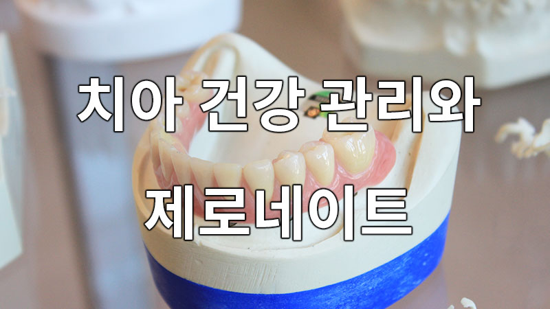 치아 건강 관리와 제로네이트, 무삭제 라미네이트