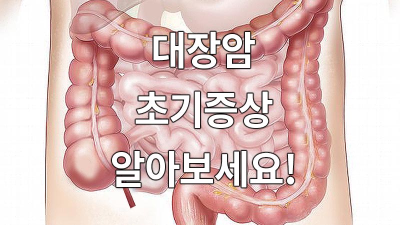 대장암 초기증상, 이렇게 알아보세요!