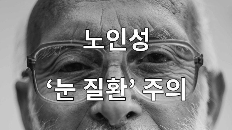 노인성 눈 질환 주의