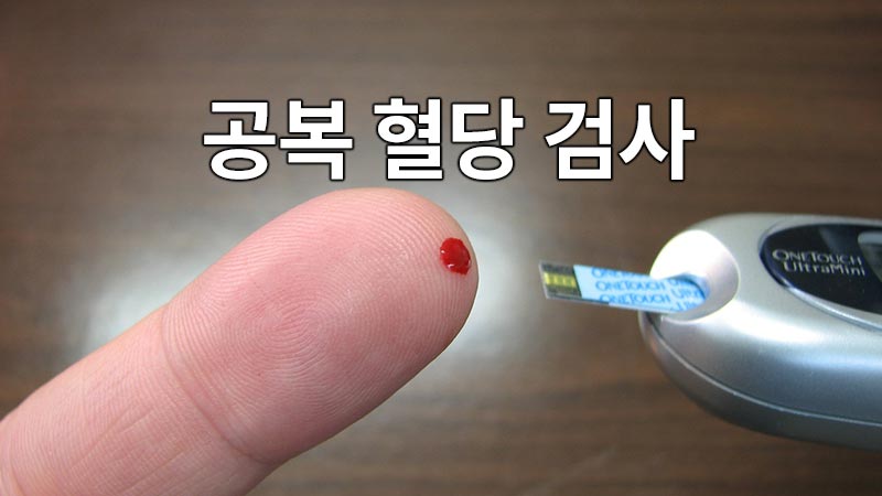 공복 혈당 검사 : 당뇨병은 우리 몸이 혈당을 제대로 처리하지 못하는 상태를 말합니다. 이를 알아내는 가장 기본적인 방법 중 하나가 바로 공복 혈당 검사입니다.
