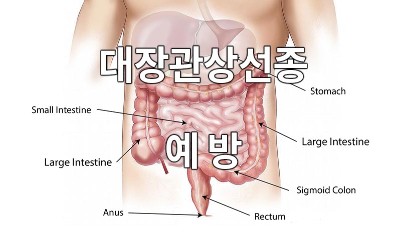 대장관상선종의 예방