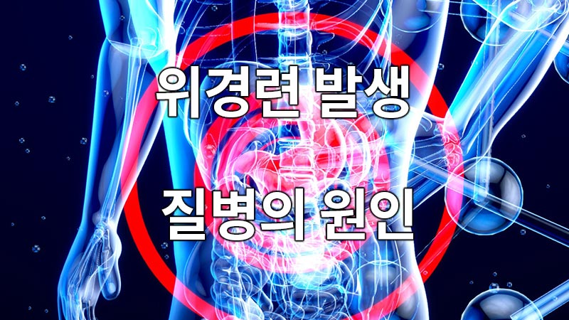 위경련 발생 질병의 원인