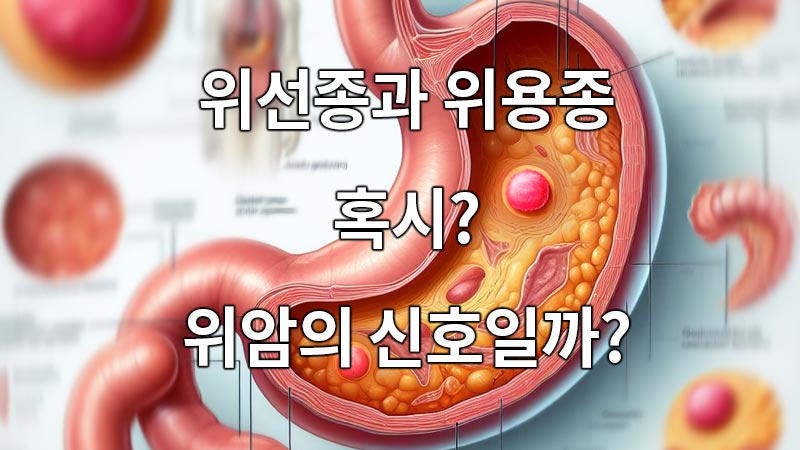 위선종과 위용종, 혹시? 위암의 신호일까?
Hypocrine and gastric polyps? Is it a sign of stomach cancer?
