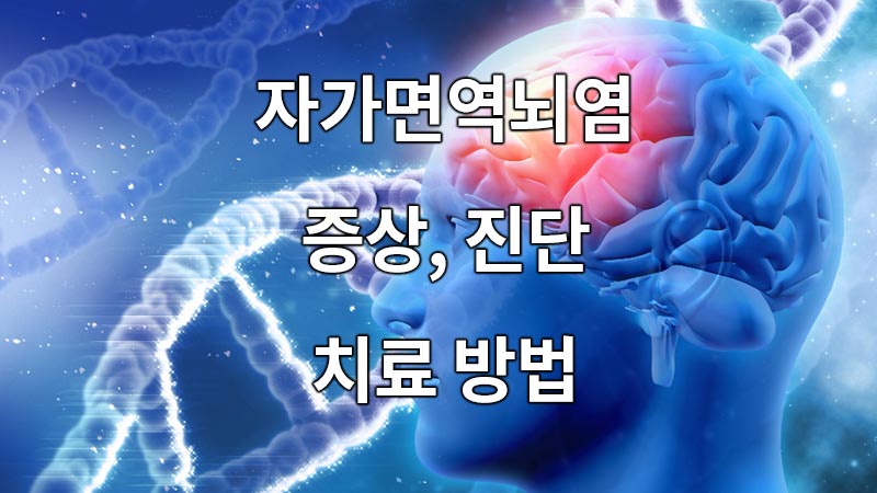 자가면역뇌염의 증상, 진단, 치료방법.