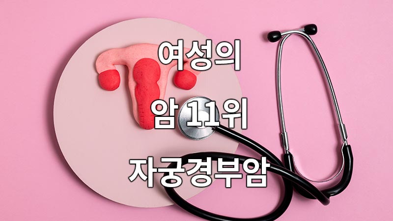 여성의 암 11위 자궁경부암
Cervical Cancer in Women's 11th Place for Cervical Cancer
