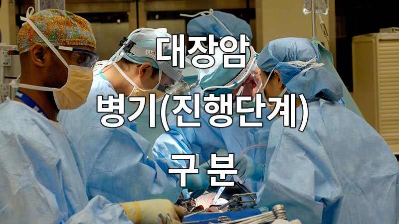 대장암 병기(진행단계)의 구분