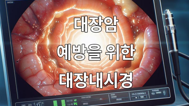 대장암 예방을 위한 대장내시경