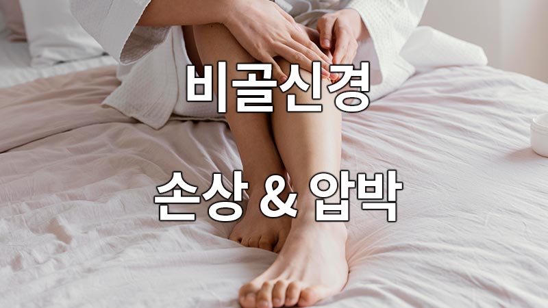 비골신경 손상과 압박