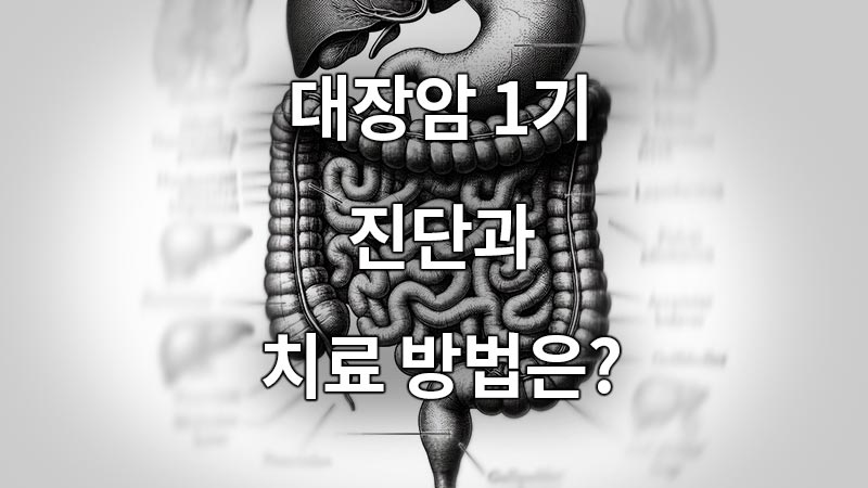 대장암 1기 진단과 치료 방법은?