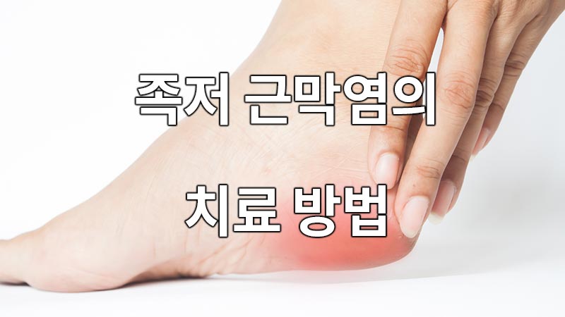 발 뒤꿈치 통증, 족저 근막염 치료 방법