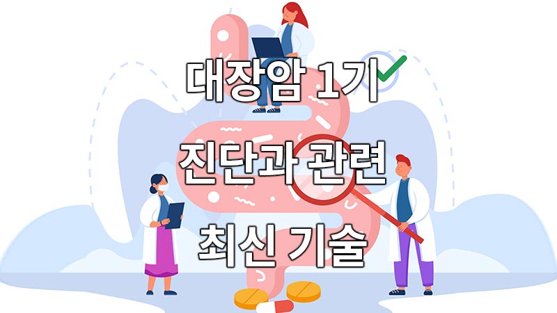 대장암 1기 진단과 관련 최신 기술