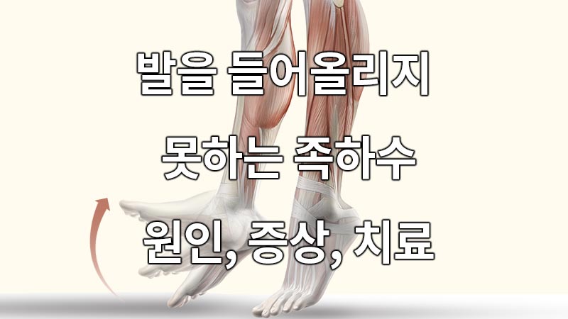 발을 들어올리지 못하는 족하수, 원인과 증상, 치료방법