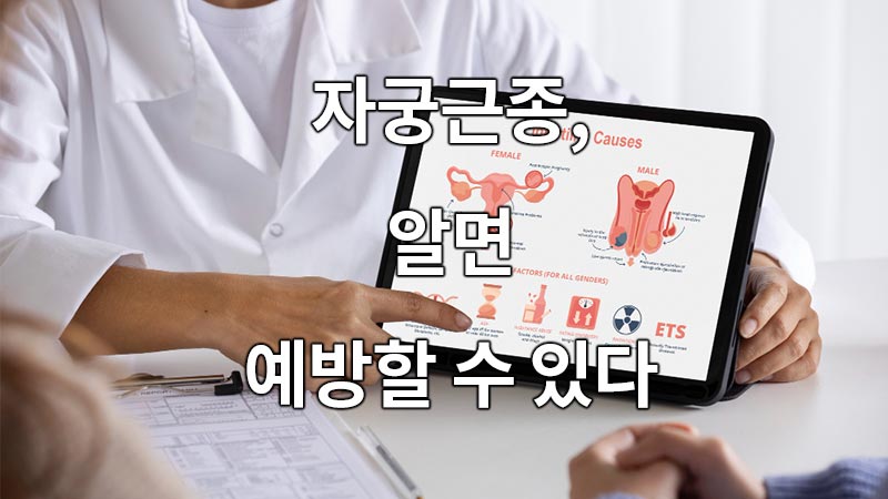 자궁근종, 알면 예방할 수 있다
Uterine fibroids can be prevented if you know
