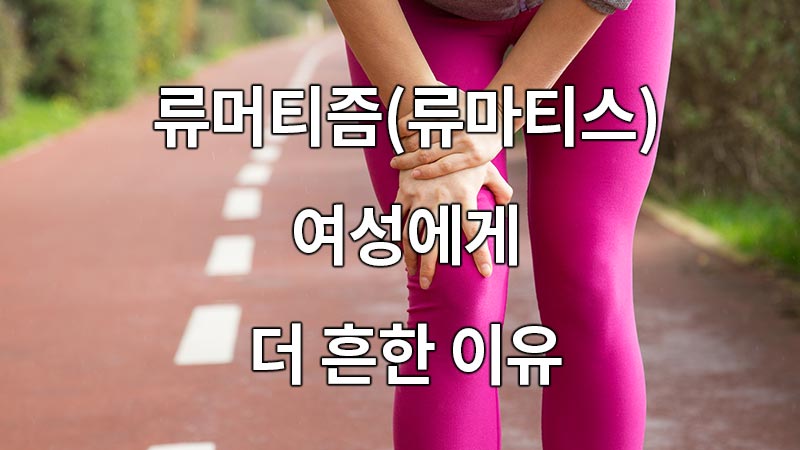 류머티즘(류마티스) 여성에게 더 흔한 이유는?
Why is it more common in rheumatoid (rheumatoid) women?