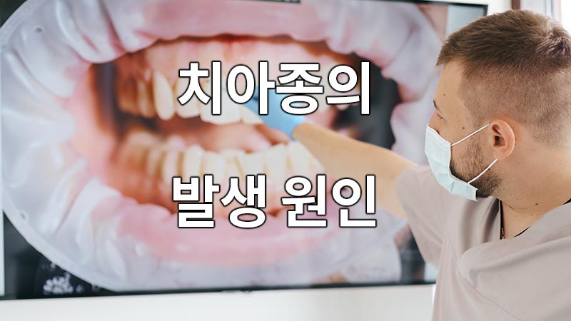 치아종의 발생 원인
the cause of the occurrence of a dental species
