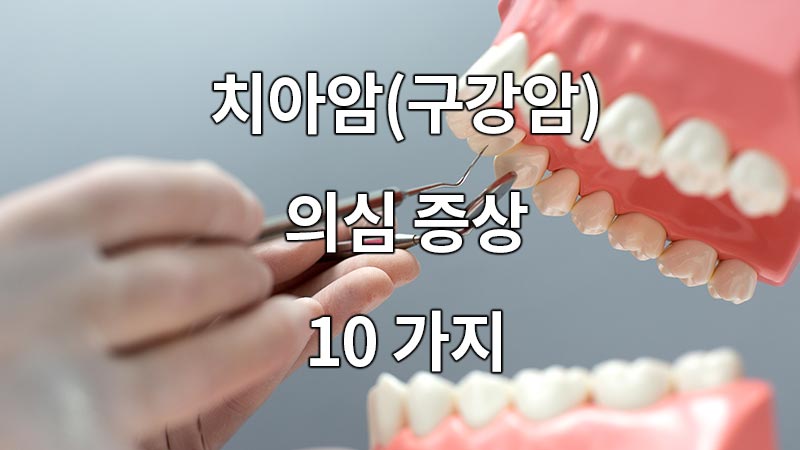 치아암(구강암)의심 증상 10가지
10 Suspicious Symptoms of Teeth and Lives