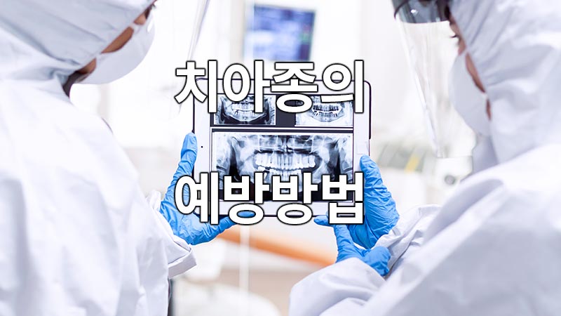 치아종 예방방법
How to prevent dental species
