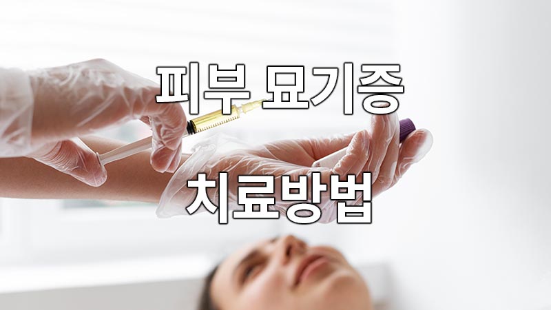 피부 묘기증의 치료방법
Treatment of Skin Surgeons
